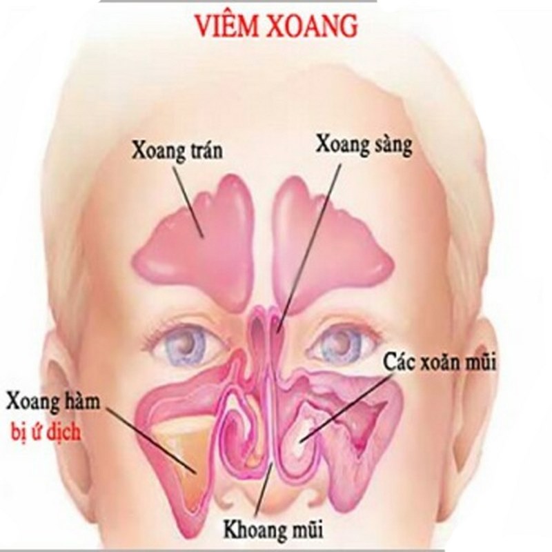 Bác sĩ đề xuất phương pháp điều trị phù hợp