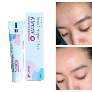 Gel hỗ trợ giảm mụn Klenzit MS dịu nhẹ