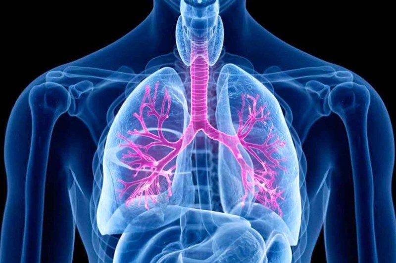 Nguyên nhân của hội chứng phế quản