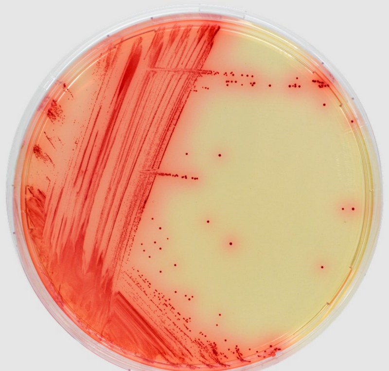 Phương pháp chuẩn đoán bệnh do khuẩn Mycoplasma gây ra