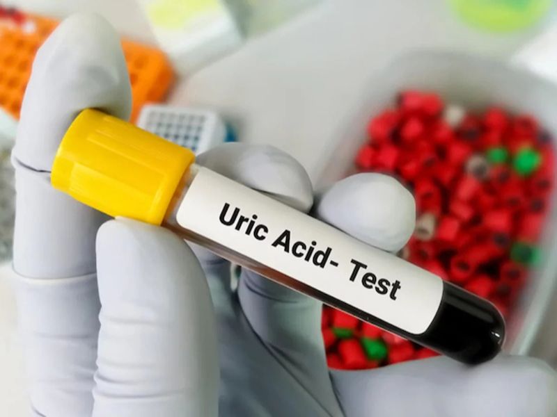 Acid uric thấp cảnh báo nhiều nguy cơ sức khỏe