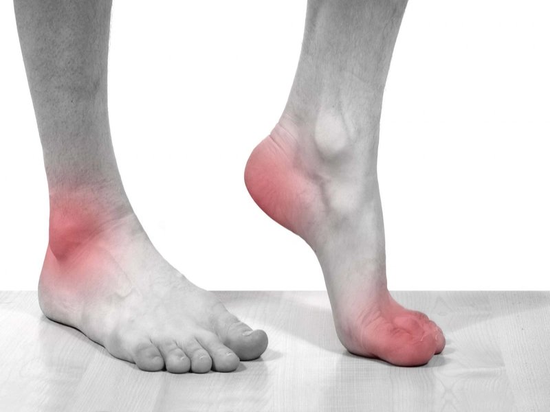 Người bệnh gout sẽ phải vô cùng khổ sở để chống chọi với những cơn đau