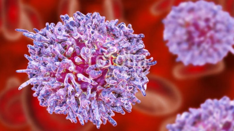 Có nhiều nguyên nhân khác nhau gây ra bệnh Leukemia