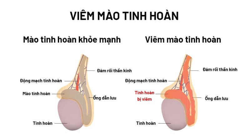 Tinh hoàn có cấu tạo phức tạp với nhiều phần khác nhau