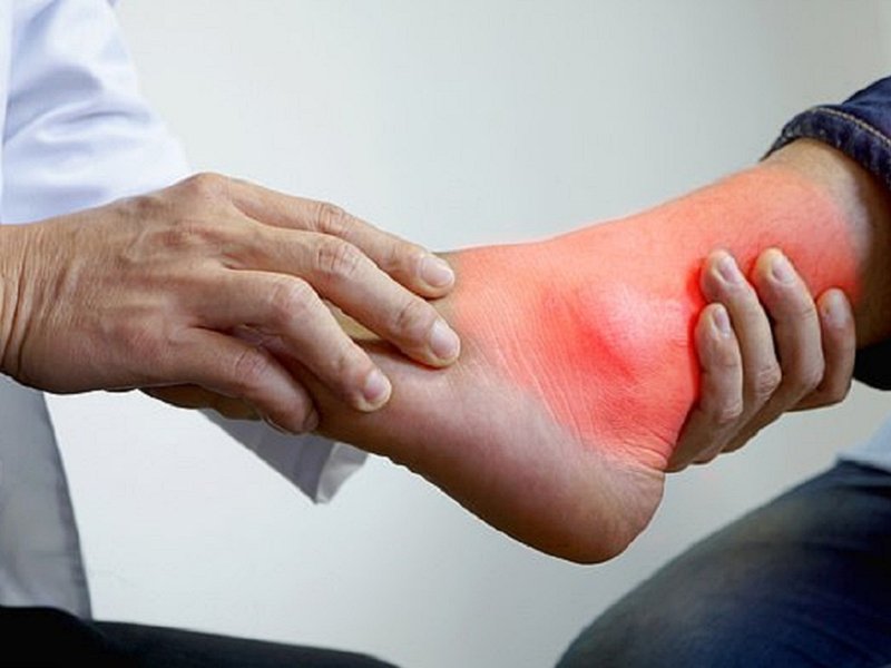 Bệnh nhân bị gout khó cử động được khớp bình thường