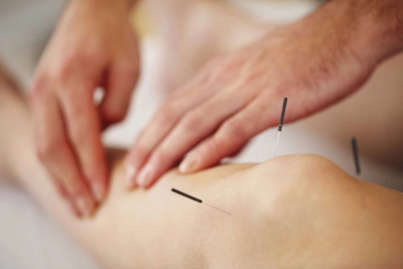 Cách chữa đau khớp gối bằng châm cứu