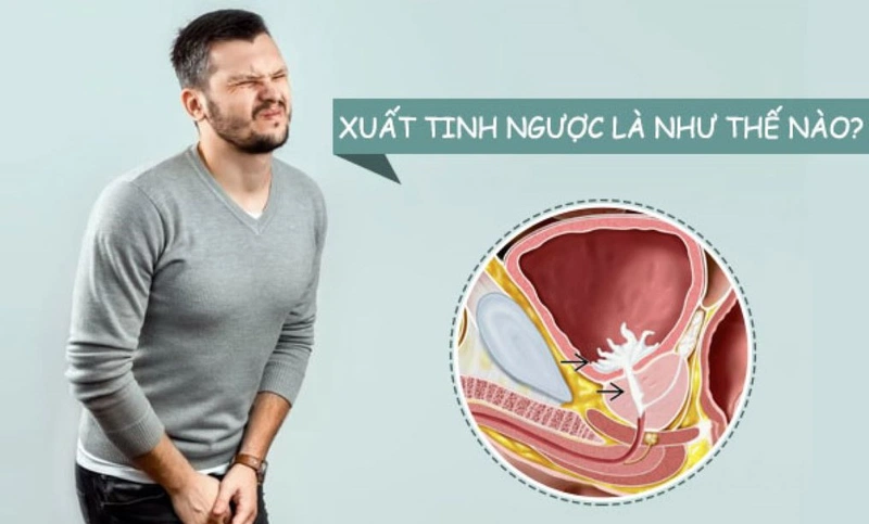 Xuất tinh ngược là một hiện tượng khá hiếm gặp