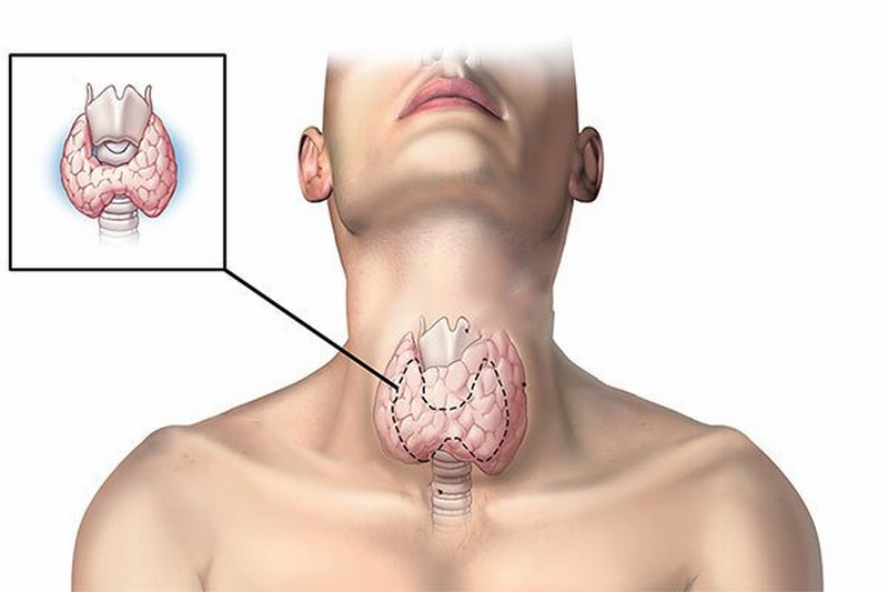 Điều trị bệnh tuyến giáp