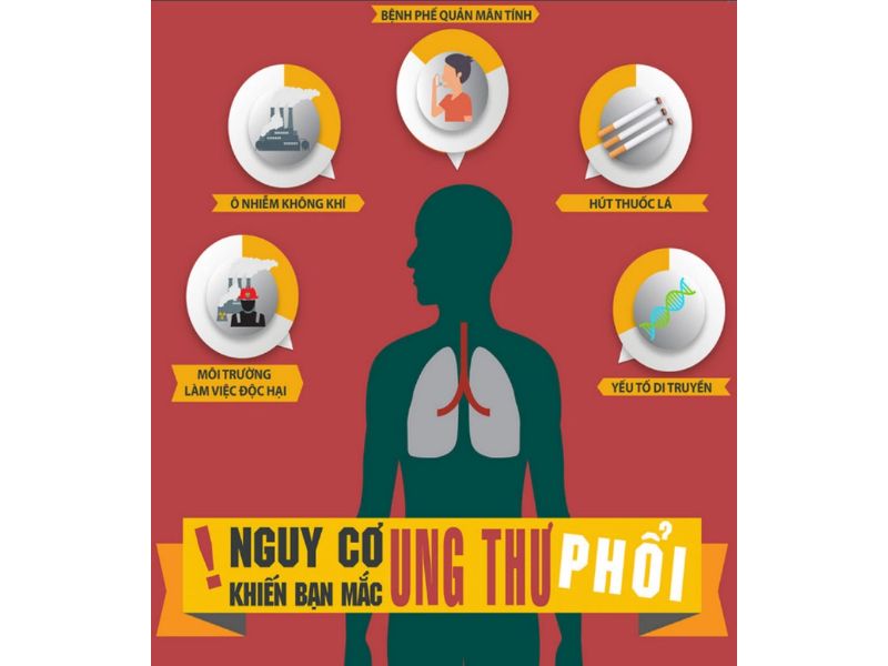 Nguyên nhân dẫn đến ung thư phổi ở nam giới