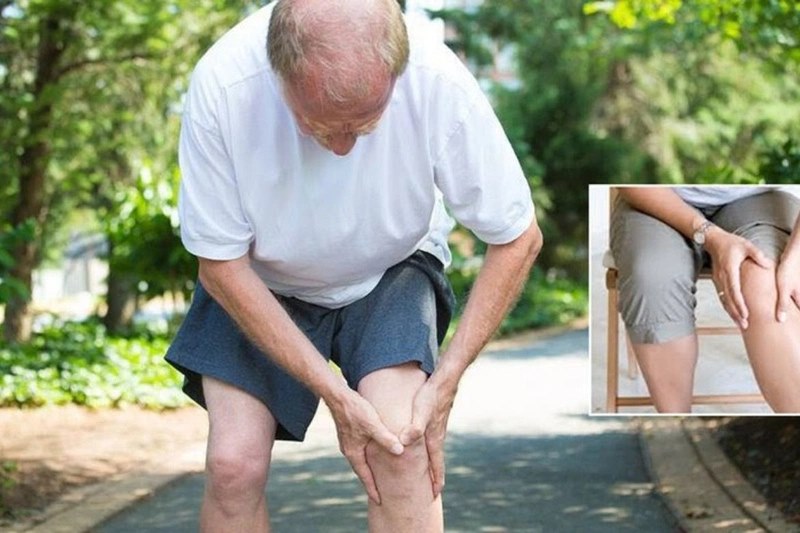 Gout gây sưng, đỏ và nóng ở khớp