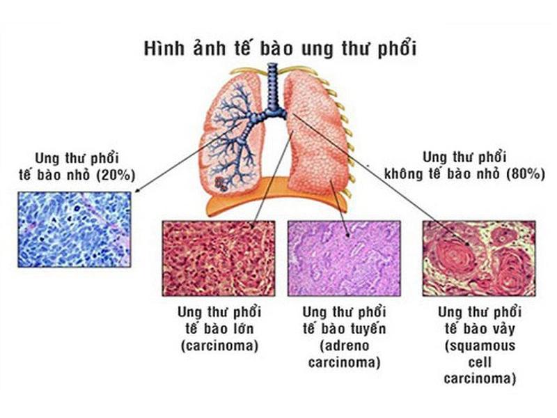 Cơ chế hoạt động của đột biến gen EGFR