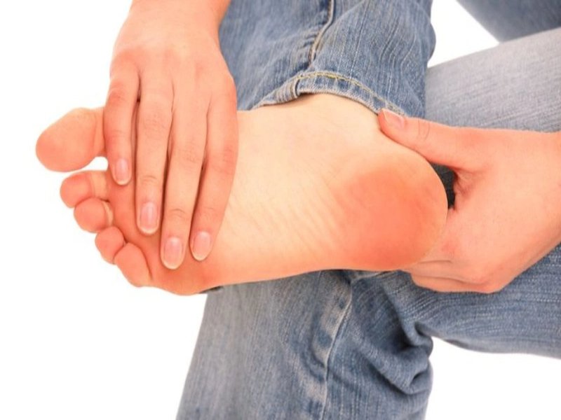 Hình ảnh bệnh gout giai đoạn 1