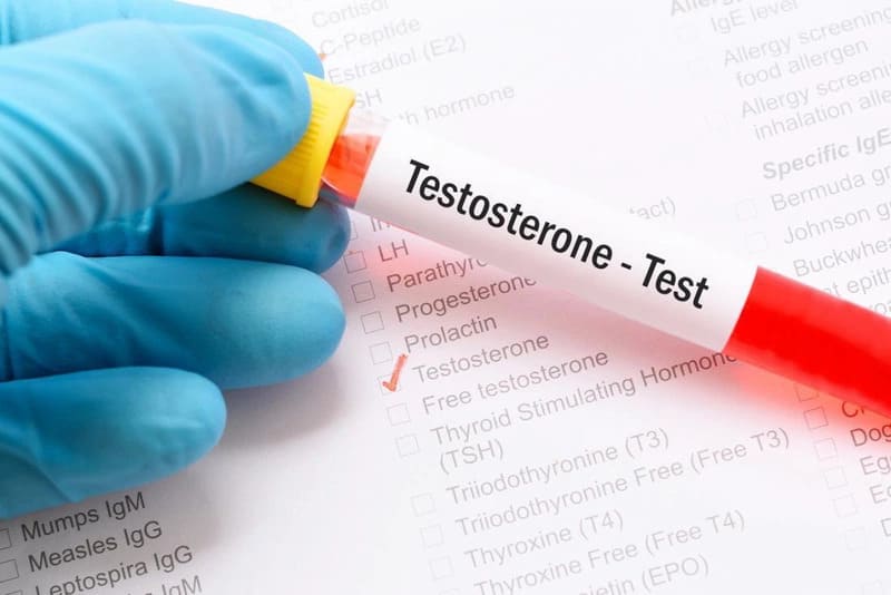 Xét nghiệm máu để đo nồng độ testosterone