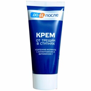 Kem hỗ trợ cải thiện nứt gót chân Nga Kpem Apteka vitamin F 50ml