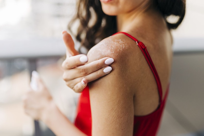 Da khô nứt nẻ là dấu hiệu thường thấy ở người có máu độc