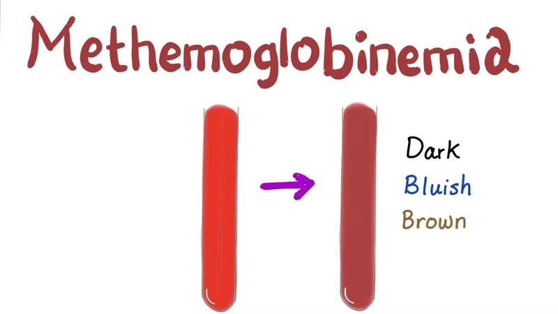 Methemoglobin là một rối loạn máu ảnh hưởng đến cách tế bào hồng cầu