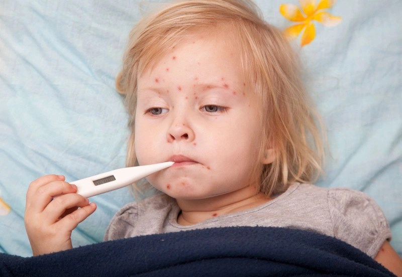 Một số khu vực trên thế giới vẫn có tỷ lệ mắc sởi, quai bị và rubella cao