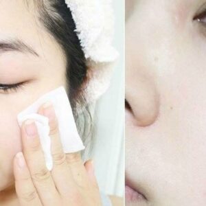 Nước hoa hồng hoa cúc Kiehl’s cho da dầu mụn