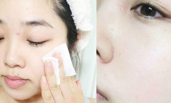 Nước hoa hồng hoa cúc Kiehl’s cho da dầu mụn