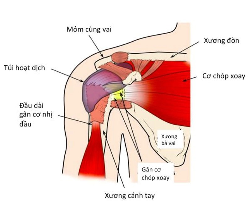 Phương pháp điều trị trật khớp cùng đòn