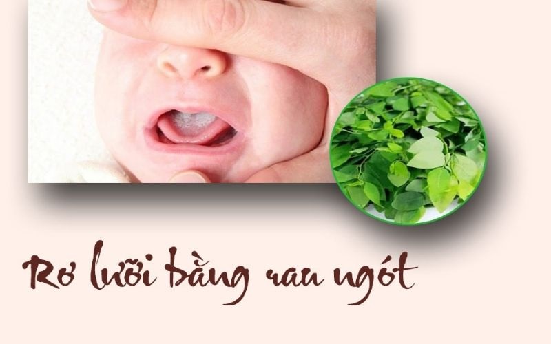 Rơ lưỡi cho trẻ sơ sinh bằng rau ngót là phương pháp dân gian hiệu quả