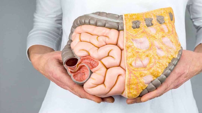 Sụt 3 kg trong 1 tháng có thể là do bệnh lý đường ruột