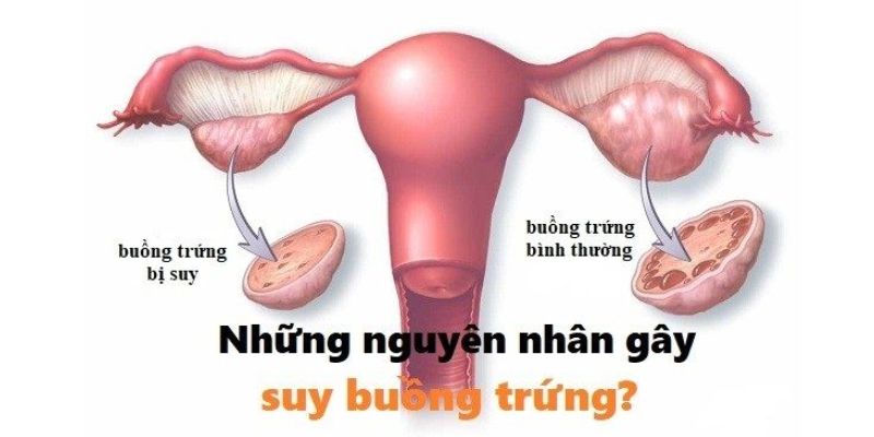 Nguyên nhân dẫn đến suy buồng trứng sớm