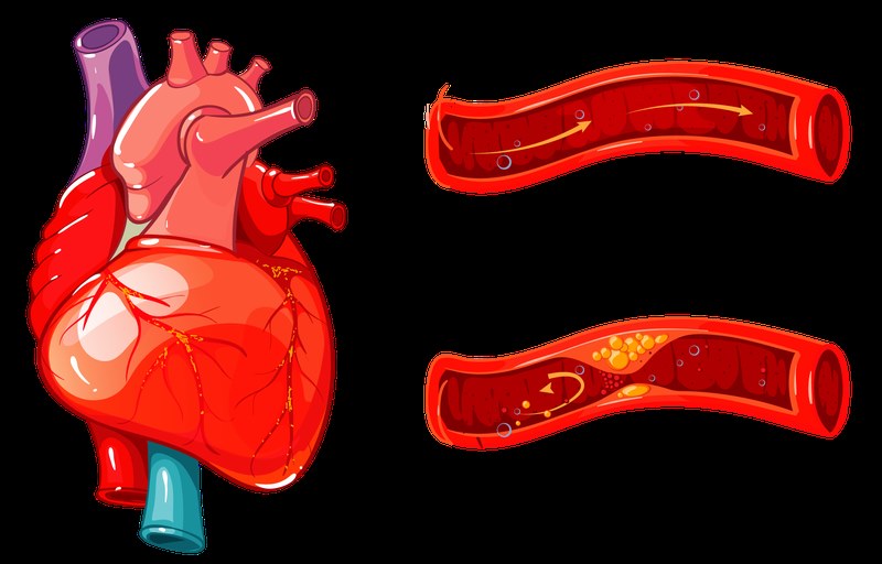  triệu chứng của tăng tiểu cầu tiên phát