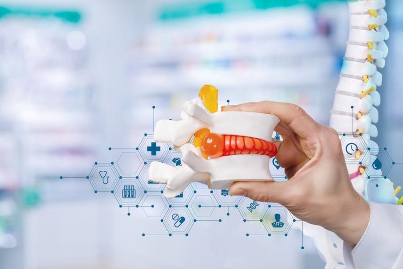 Thoát vị đĩa đệm chèn dây thần kinh gây ra những ảnh hưởng không nhỏ đến người bệnh