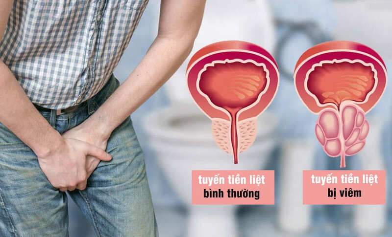 Tinh trùng lạnh có gây vô sinh ở nam không?