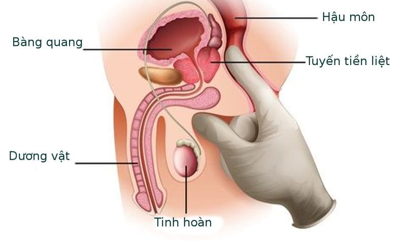 Cơ vòng bàng quang không đủ mạnh để giữ tinh dịch