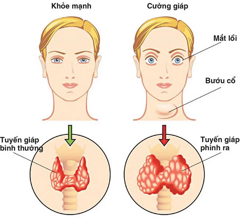 Tuyến giáp có vai trò gì đối với cơ thể