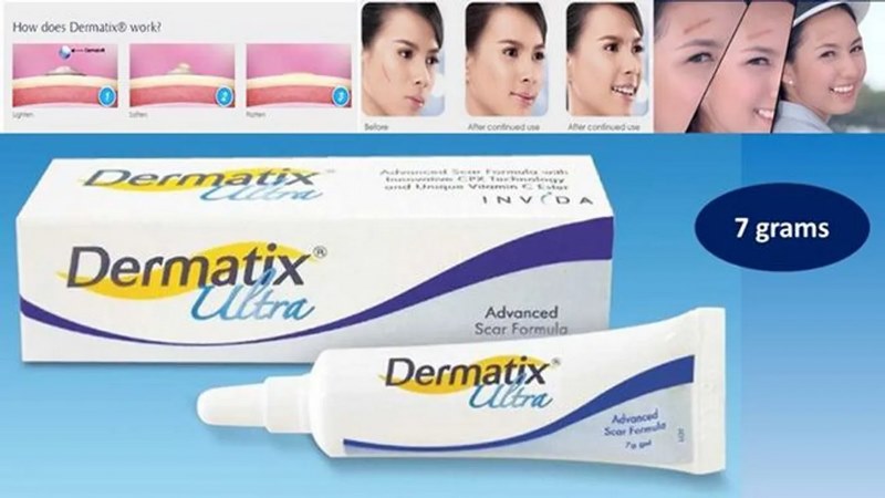 Dermatix Ultra là một sản phẩm gel silicone trị sẹo