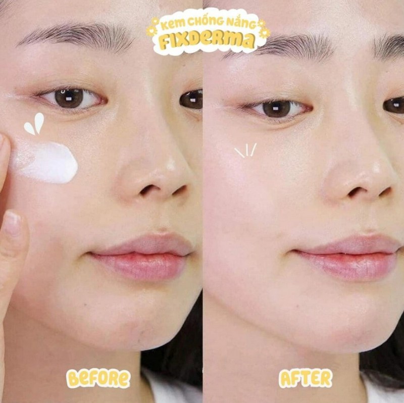 Kem chống nắng Fixderma Shadow Cream có tốt không?