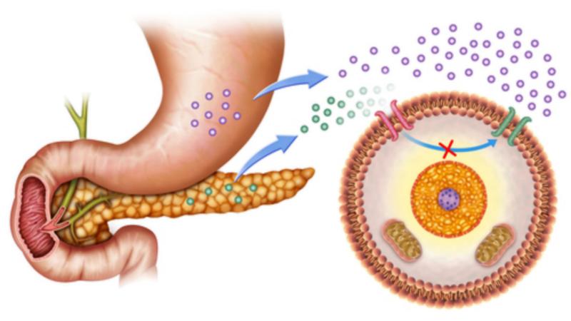 Nhiễm toan đái tháo đường (DKA) đe dọa tính mạng