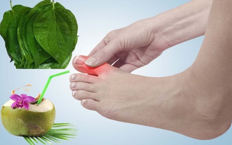 Chữa bệnh gout bằng lá trầu và nước dừa đơn giản và cực kỳ khoa học