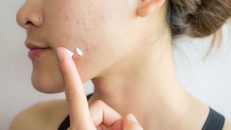 Những điều cần biết khi sử dụng Decumar