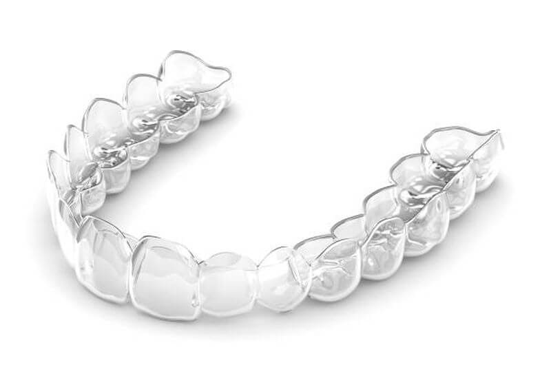 Niềng răng Clear Aligner sử dụng các khay nhựa trong suốt