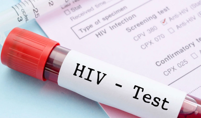 HIV có thể tồn tại trong tinh dịch của người nhiễm