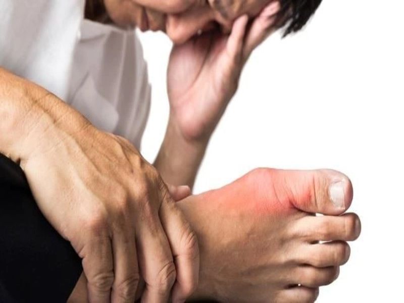 Bệnh gout là căn bệnh nguy hiểm gây nhiều đau đớn về xương khớp