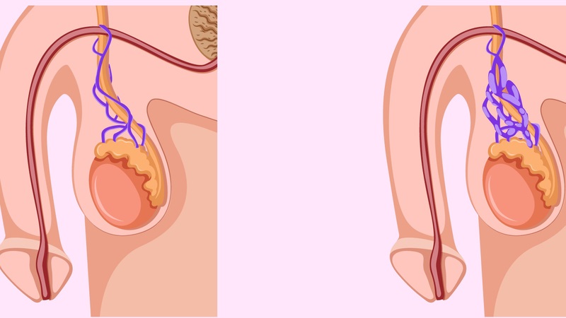 Biến chứng có thể gặp và cách phòng tránh