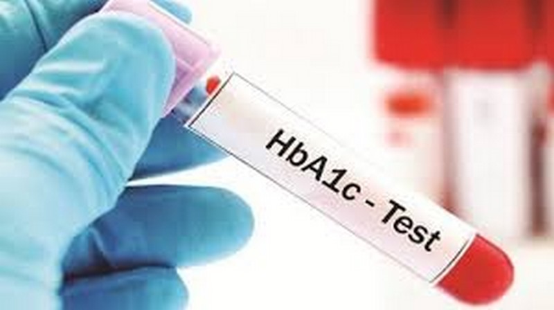 Xét nghiệm HbA1c đo lượng đường glucose