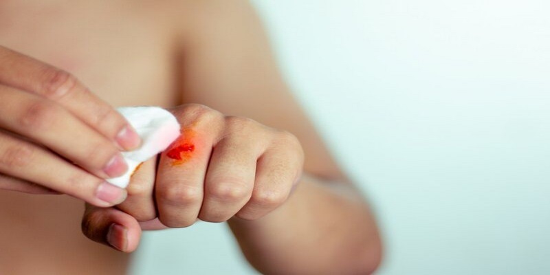 Loại thuốc đỏ này được sử dụng phổ biến trong sát khuẩn các vết thương hở