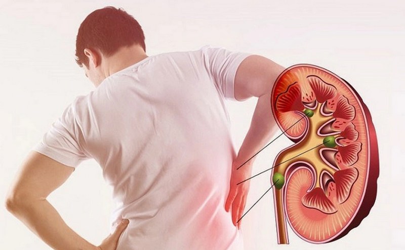 Suy thận là gì? Cấu trúc và chức năng của thận
