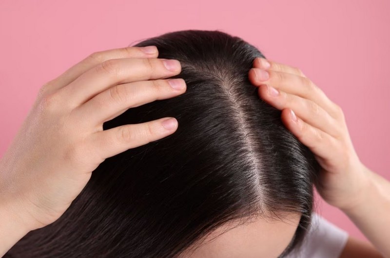 Da đầu bị khô do làm sạch quá mức