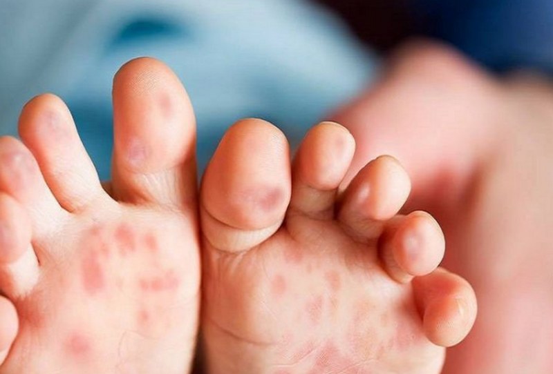 Khi nào cần đến sư tư vấn chuyên sâu của bác sĩ