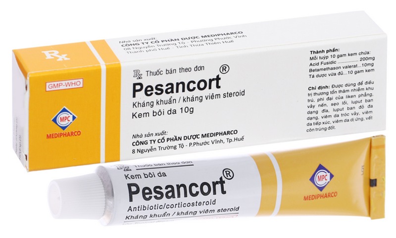 Thuốc bôi kết hợp corticoid giảm ngứa nhanh